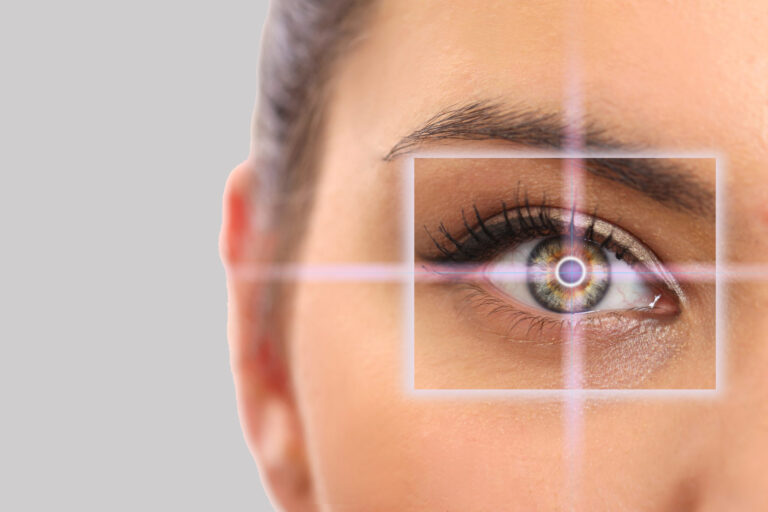 Laser eye surgery